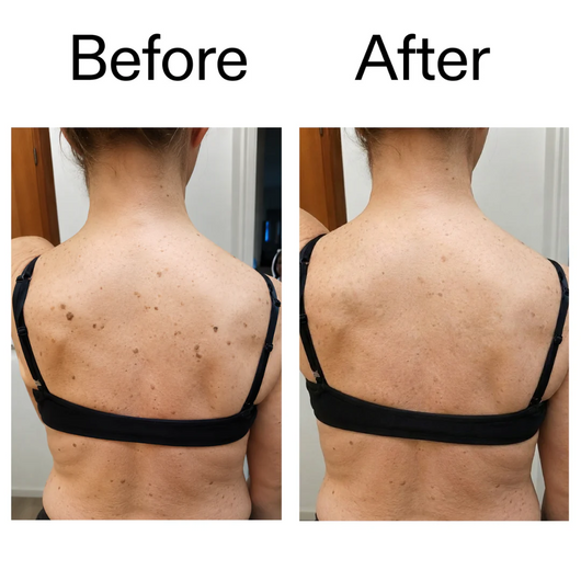 Exfoliating Glycolic Acid Body Stick