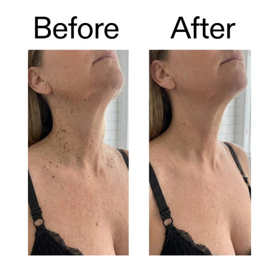 Exfoliating Glycolic Acid Body Stick