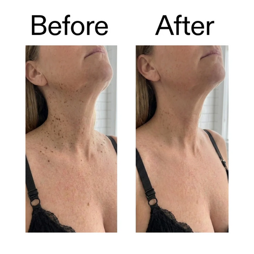 Exfoliating Glycolic Acid Body Stick